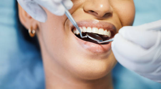 Best Cosmetic Emergency Dentistry in Romeo, MI